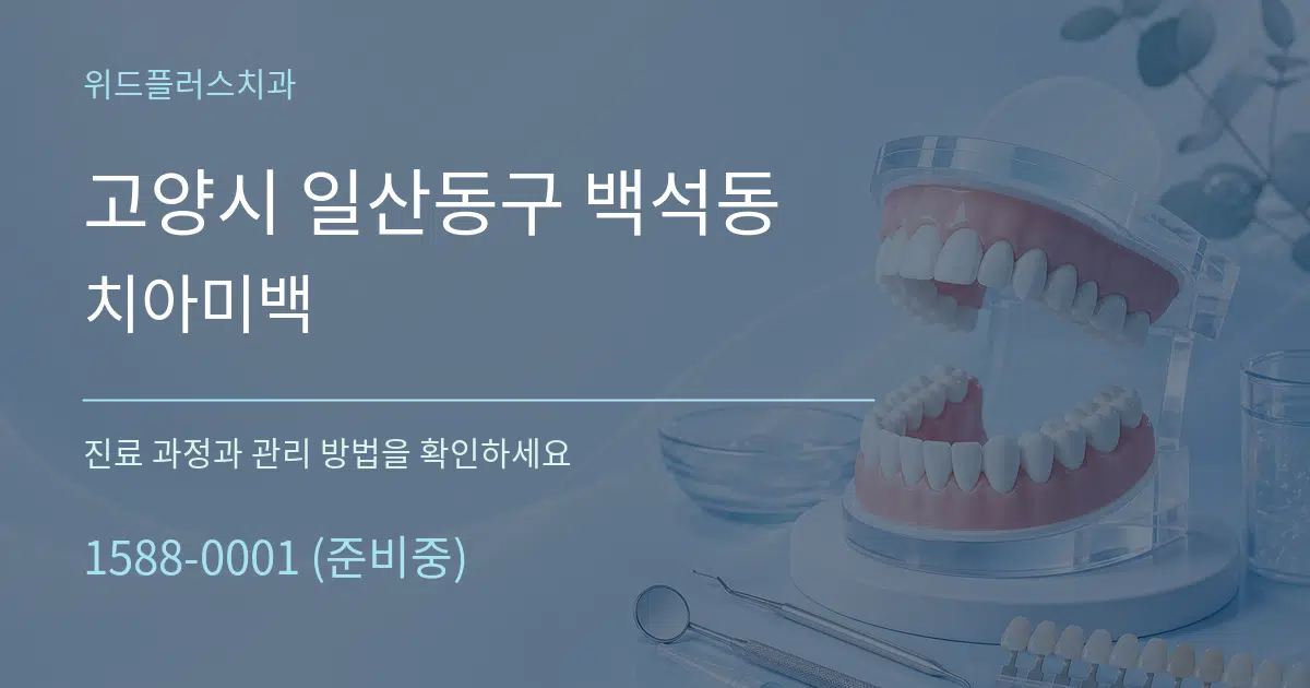 고양시 일산동구 백석동 치아미백 서비스 이용 안내 그래픽