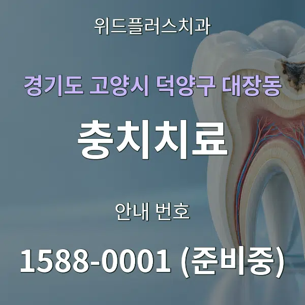 경기도 고양시 덕양구 대장동 충치치료 대표 안내 그래픽