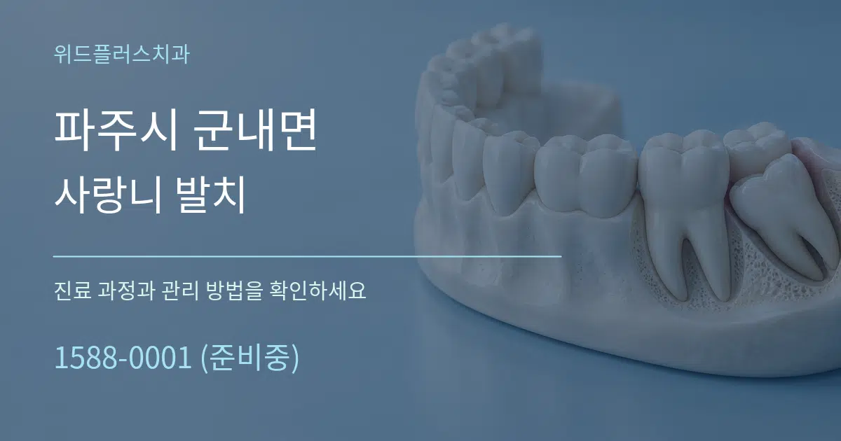 파주시 군내면 사랑니 발치 작업 조건 안내 그래픽