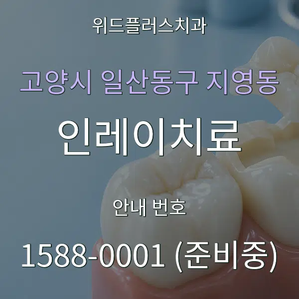 고양시 일산동구 지영동 인레이치료 대표 안내 그래픽