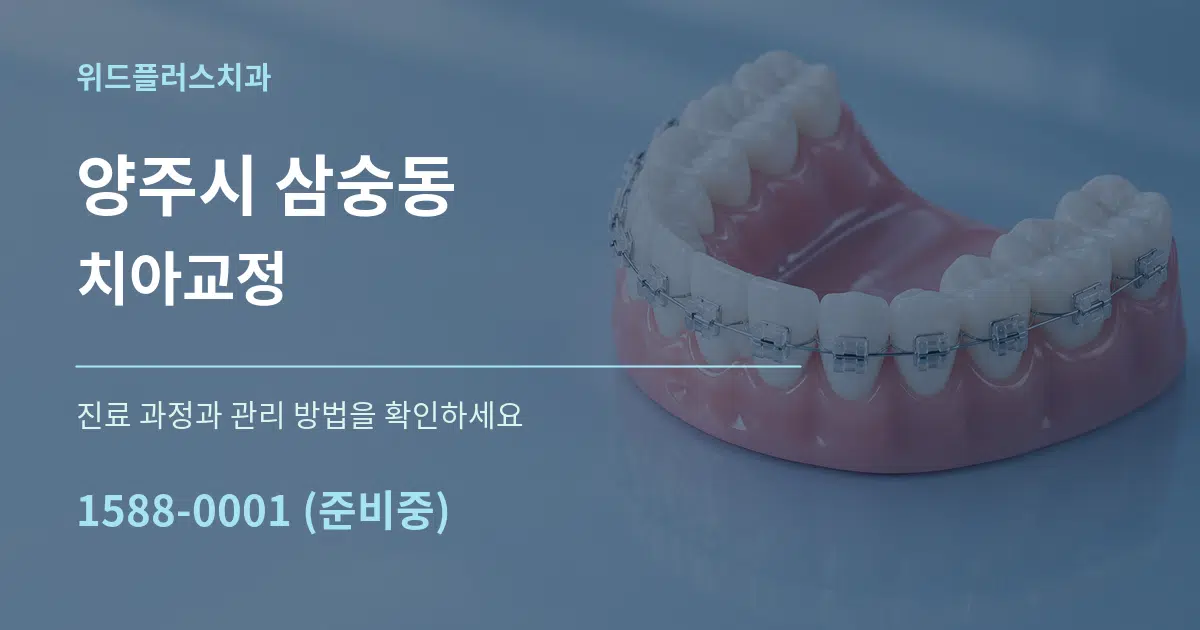 양주시 삼숭동 치아교정 작업 조건 안내 그래픽