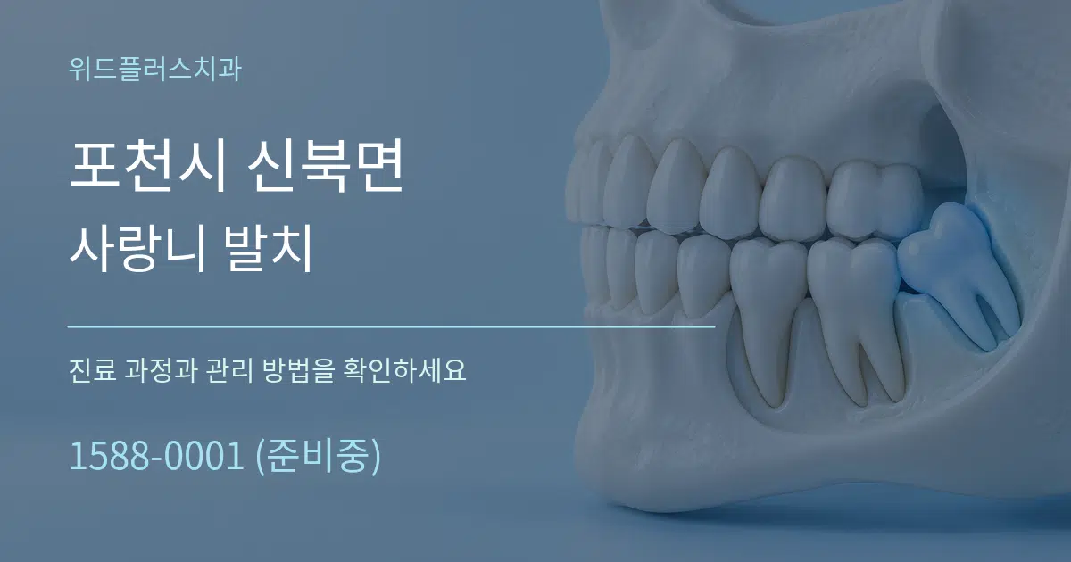 포천시 신북면 사랑니 발치 작업 조건 안내 그래픽