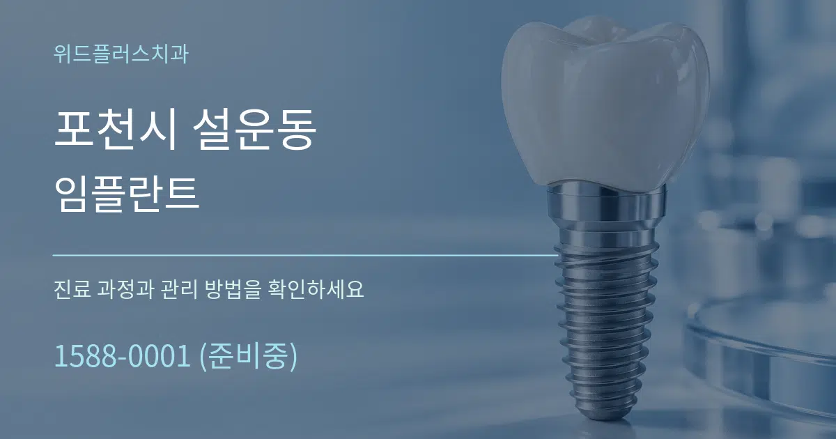 포천시 설운동 임플란트 작업 조건 안내 그래픽