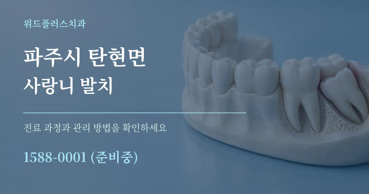 파주시 탄현면 사랑니 발치 서비스 이용 안내 그래픽