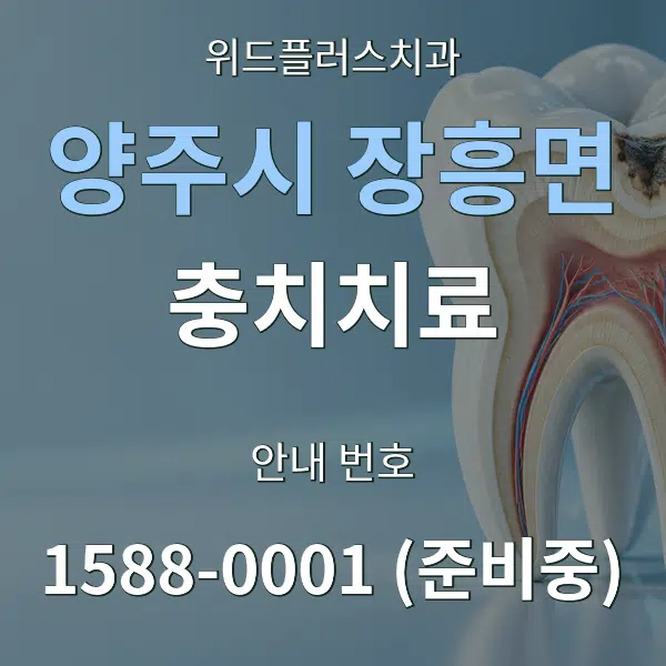 양주시 장흥면 충치치료 대표 안내 그래픽
