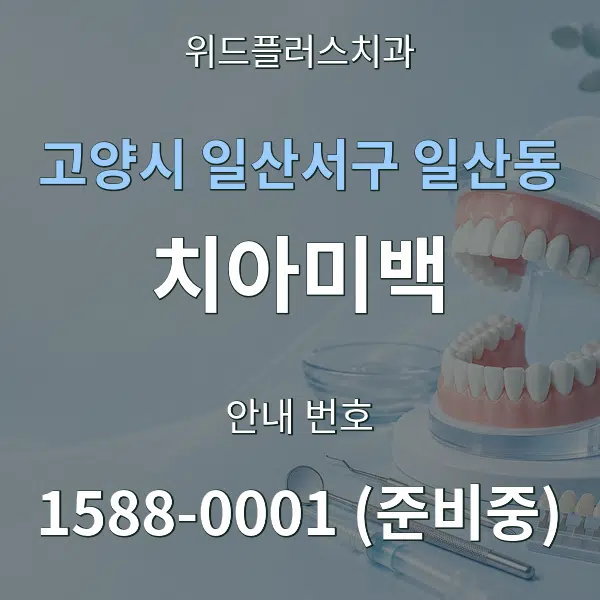 고양시 일산서구 일산동 치아미백 대표 안내 그래픽