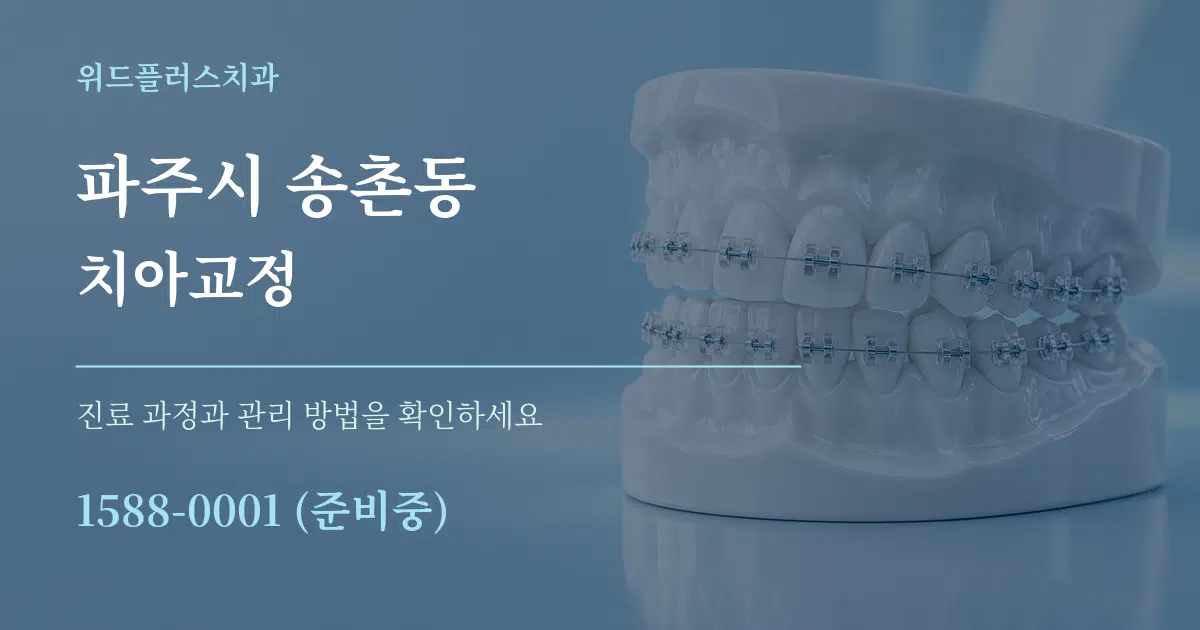 파주시 송촌동 치아교정 작업 조건 안내 그래픽
