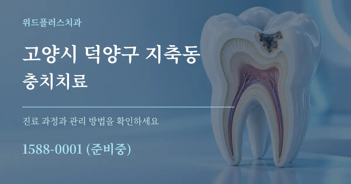 고양시 덕양구 지축동 충치치료 작업 조건 안내 그래픽
