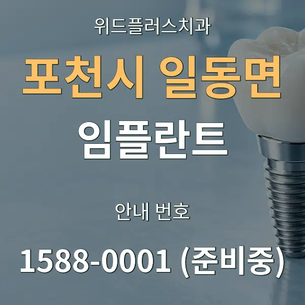 포천시 일동면 임플란트 대표 안내 그래픽