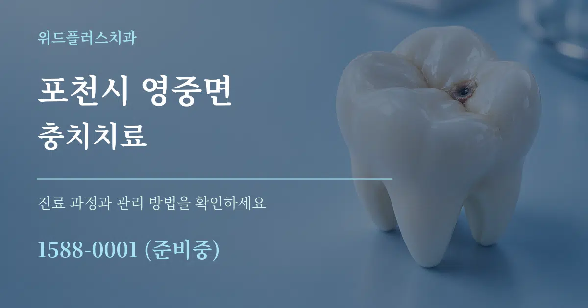 포천시 영중면 충치치료 작업 조건 안내 그래픽