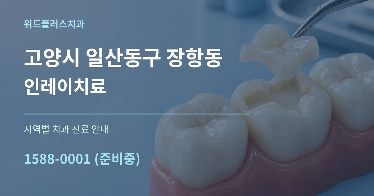 고양시 일산동구 장항동 인레이치료 대표 안내 그래픽
