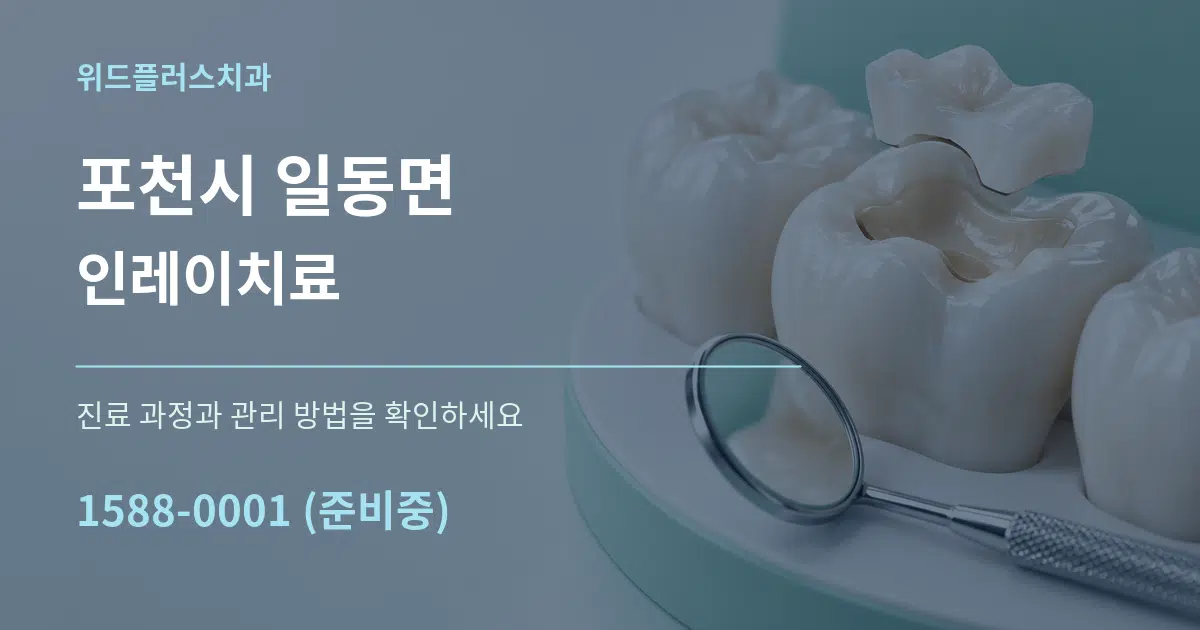 포천시 일동면 인레이치료 서비스 이용 안내 그래픽