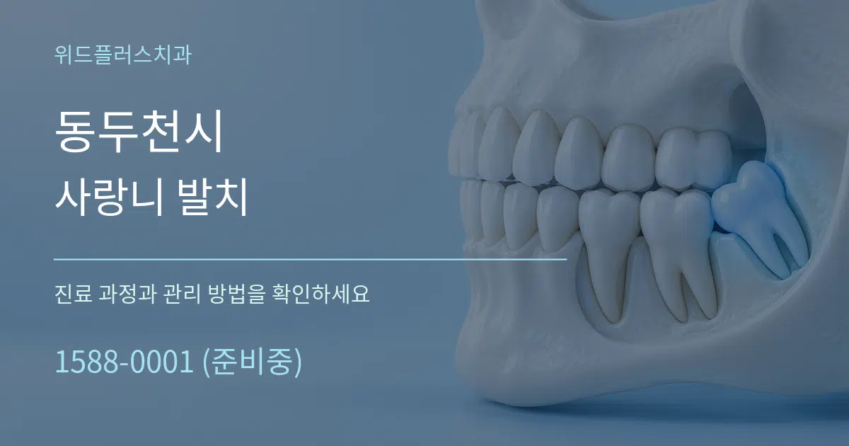 동두천시 사랑니 발치 작업 조건 안내 그래픽