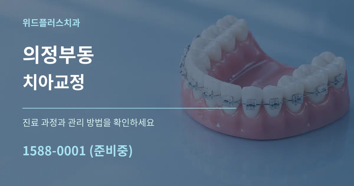 의정부동 치아교정 작업 조건 안내 그래픽