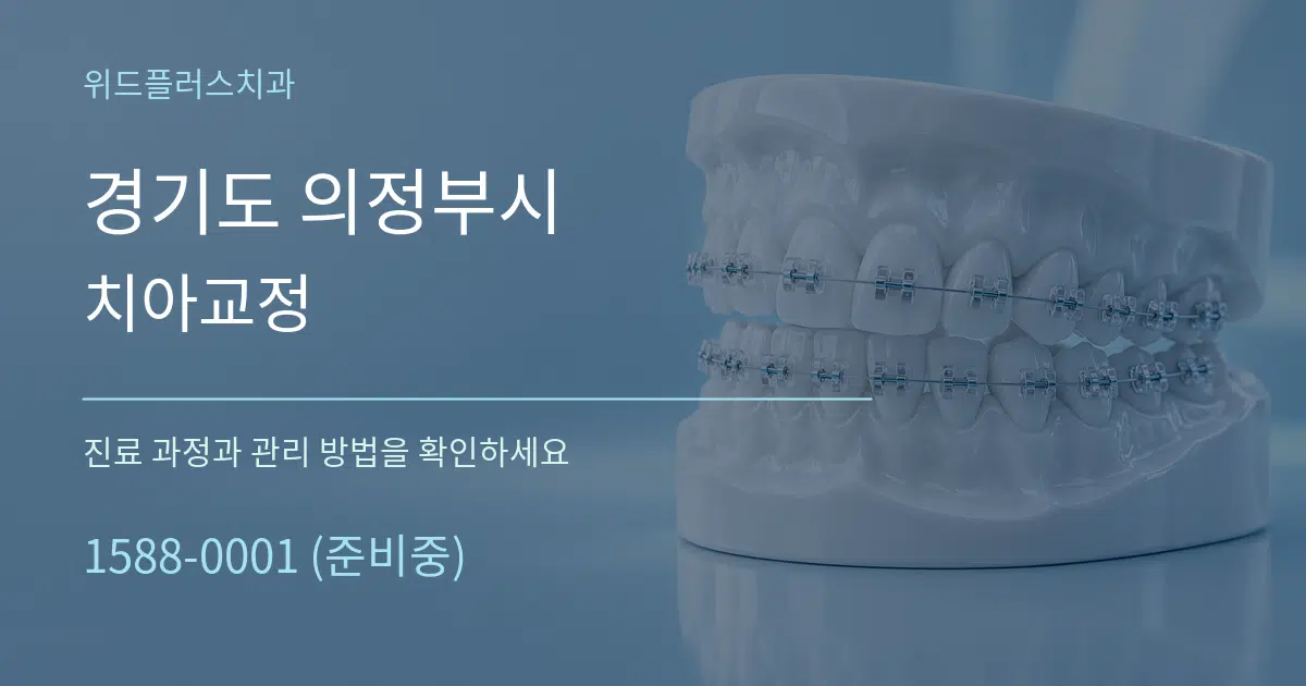 경기도 의정부시 치아교정 작업 조건 안내 그래픽