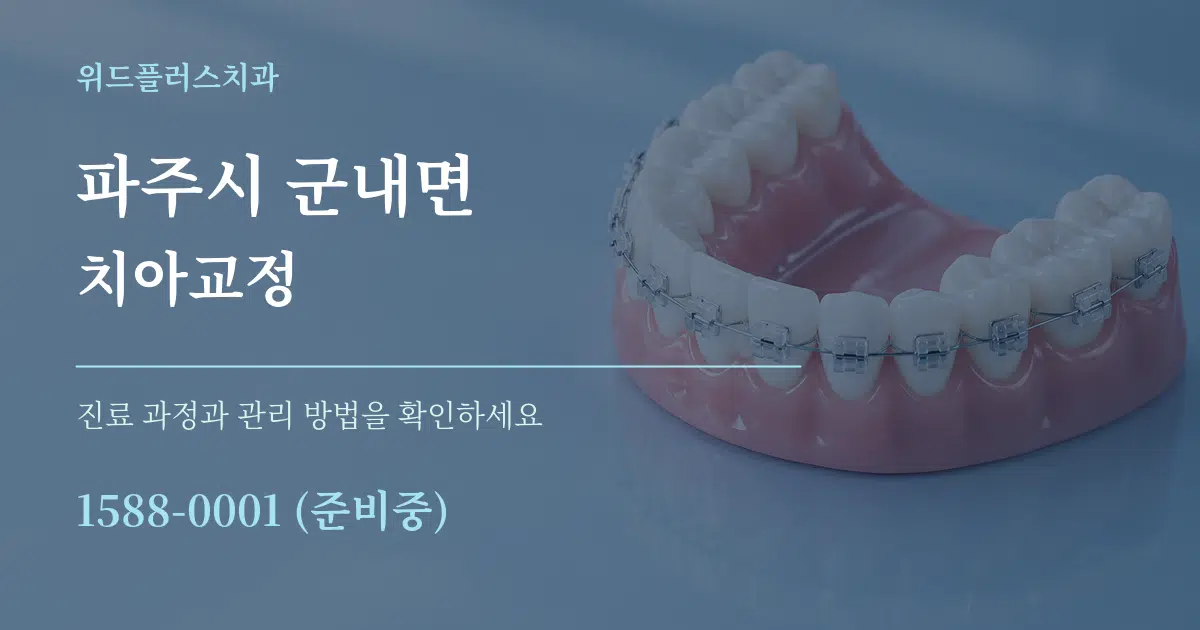 파주시 군내면 치아교정 작업 조건 안내 그래픽
