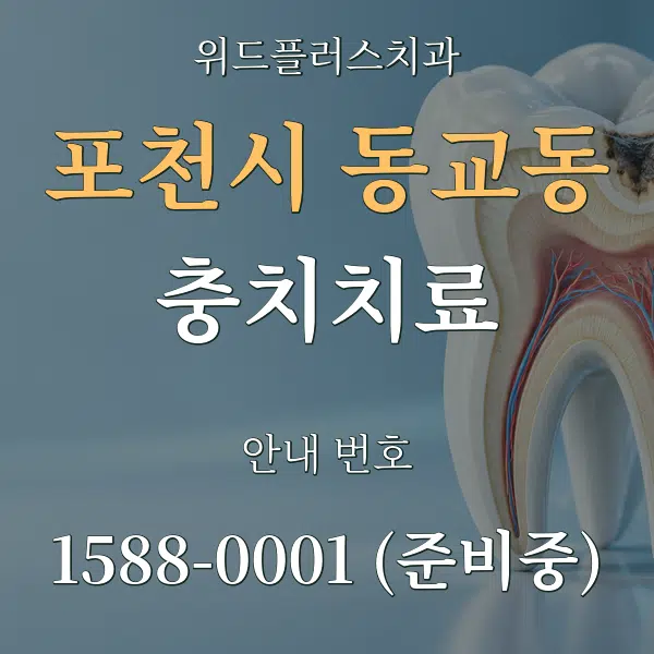 포천시 동교동 충치치료 대표 안내 그래픽