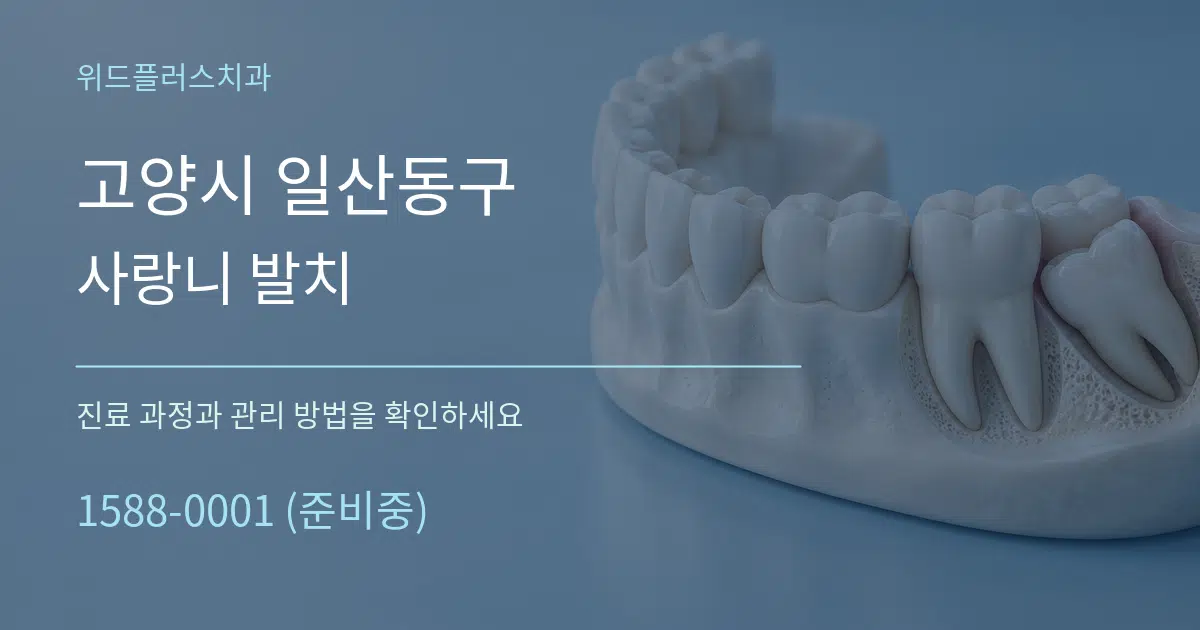 고양시 일산동구 사랑니 발치 서비스 이용 안내 그래픽
