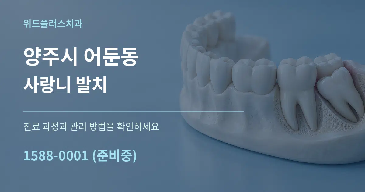 양주시 어둔동 사랑니 발치 작업 조건 안내 그래픽