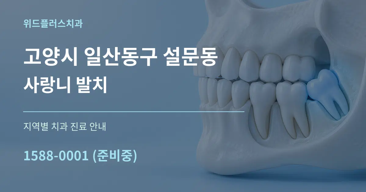 고양시 일산동구 설문동 사랑니 발치 대표 안내 그래픽