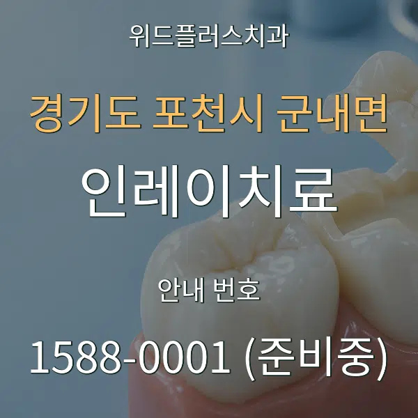 경기도 포천시 군내면 인레이치료 대표 안내 그래픽