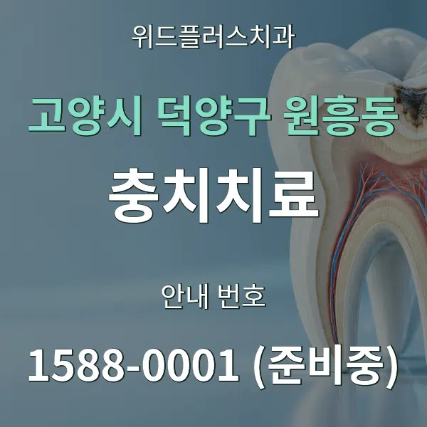 고양시 덕양구 원흥동 충치치료 대표 안내 그래픽