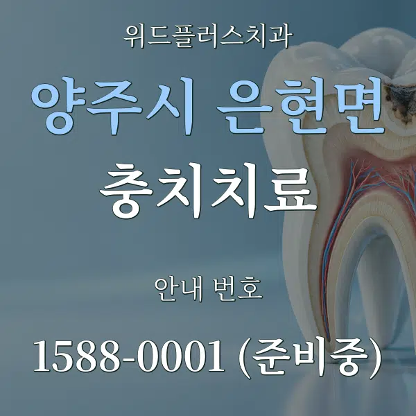양주시 은현면 충치치료 대표 안내 그래픽