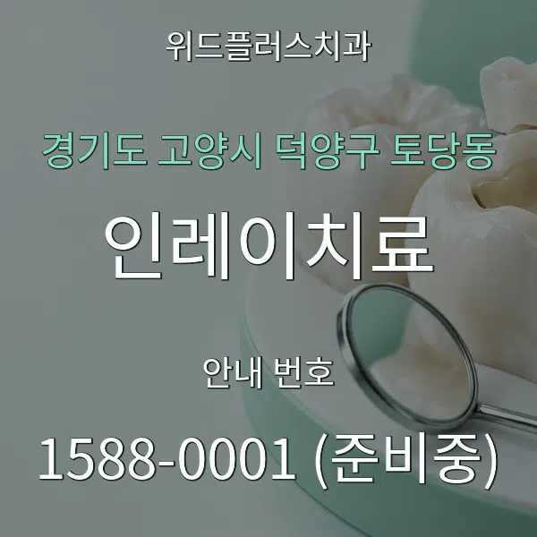 경기도 고양시 덕양구 토당동 인레이치료 대표 안내 그래픽