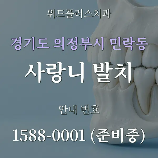 경기도 의정부시 민락동 사랑니 발치 대표 안내 그래픽