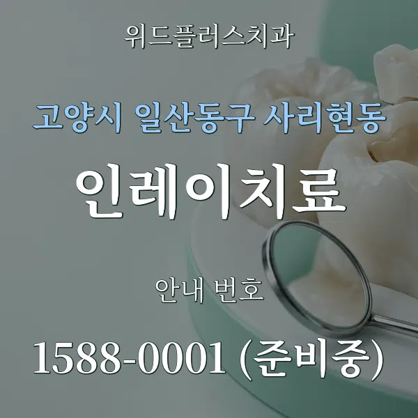 고양시 일산동구 사리현동 인레이치료 대표 안내 그래픽