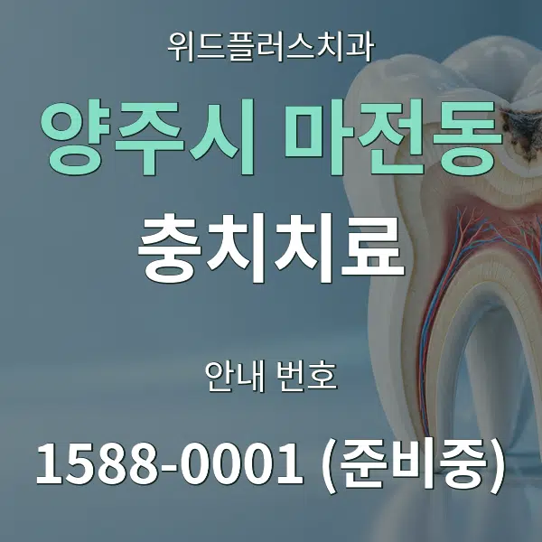 양주시 마전동 충치치료 대표 안내 그래픽