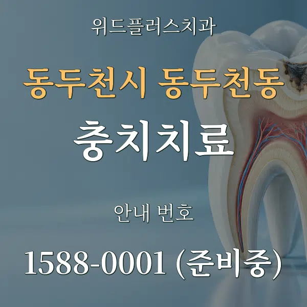 동두천시 동두천동 충치치료 대표 안내 그래픽