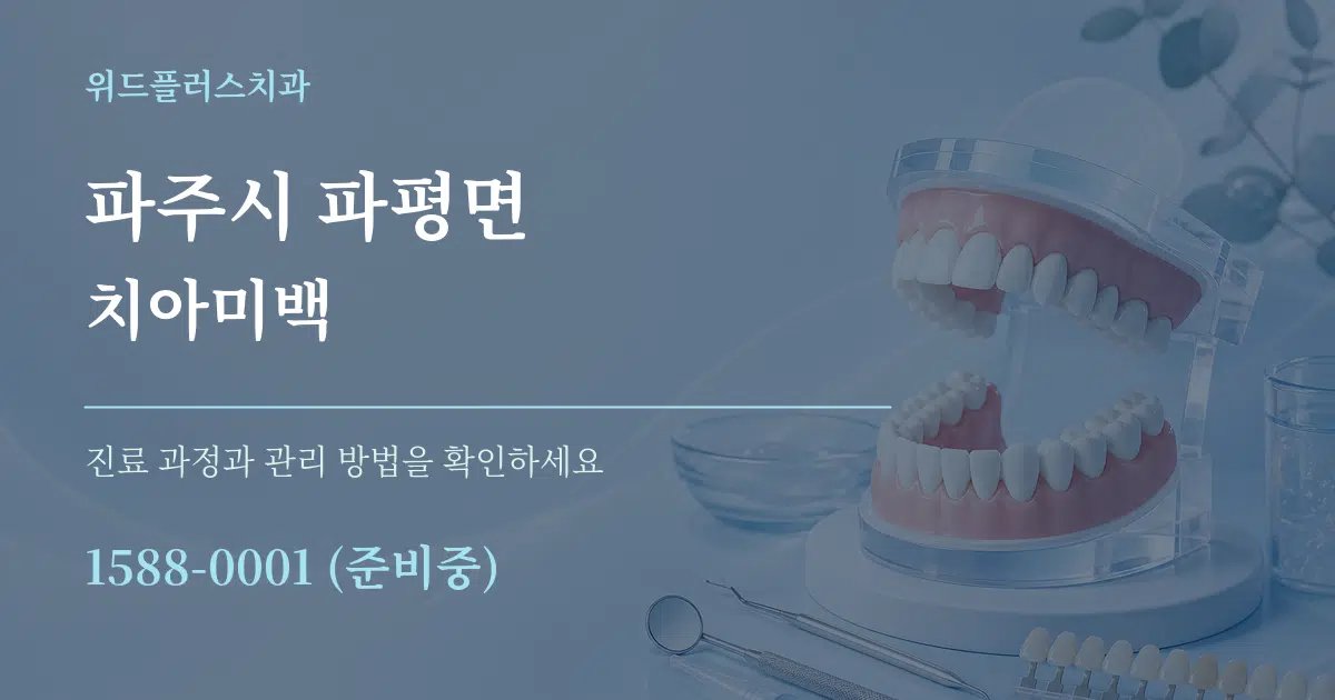 파주시 파평면 치아미백 작업 조건 안내 그래픽