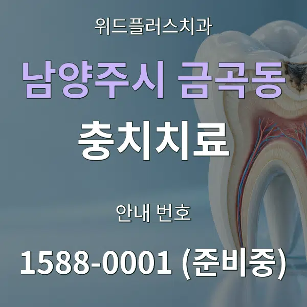 남양주시 금곡동 충치치료 대표 안내 그래픽