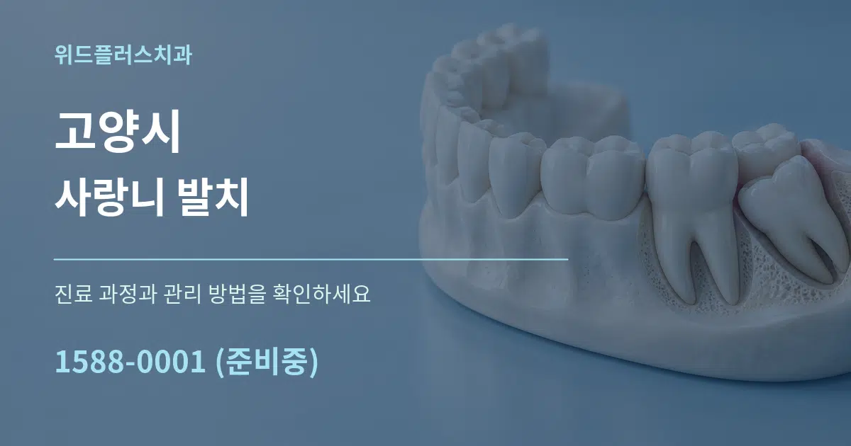 고양시 사랑니 발치 서비스 이용 안내 그래픽