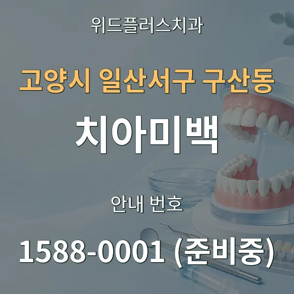 고양시 일산서구 구산동 치아미백 대표 안내 그래픽