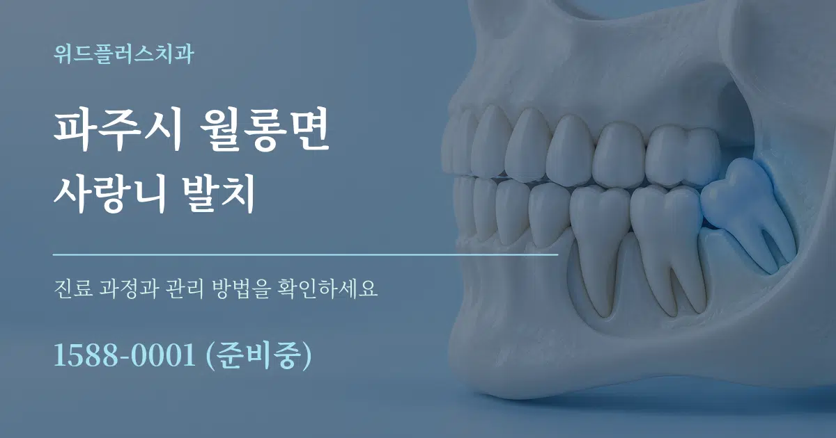 파주시 월롱면 사랑니 발치 작업 조건 안내 그래픽