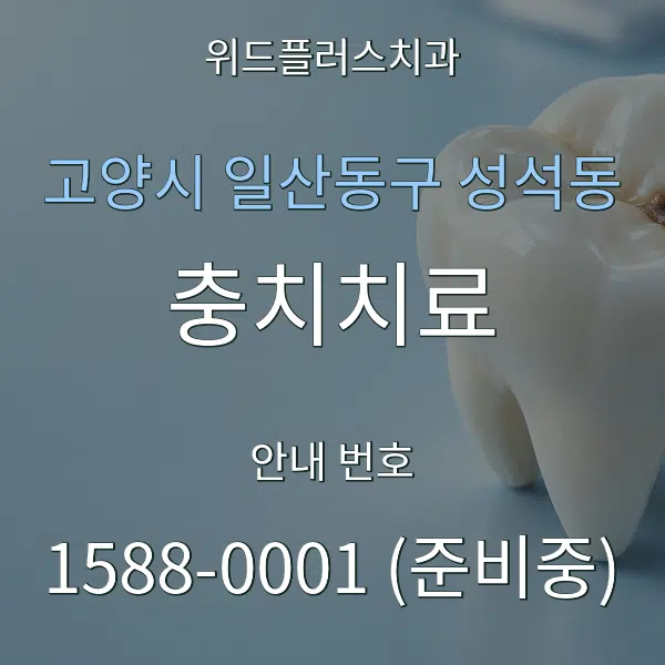고양시 일산동구 성석동 충치치료 대표 안내 그래픽