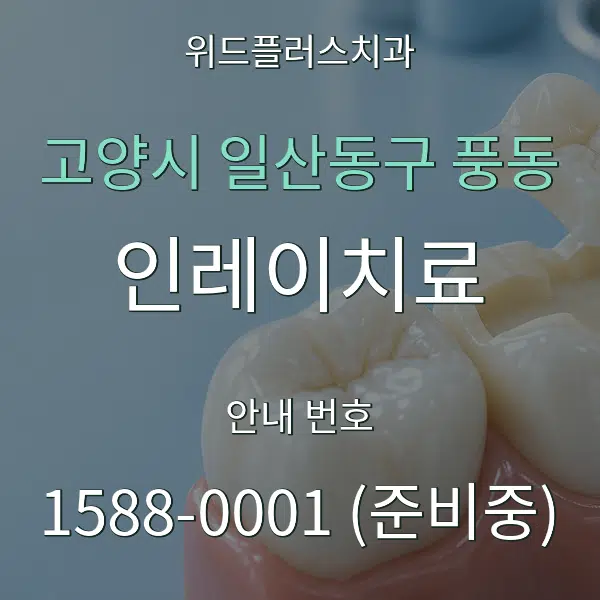 고양시 일산동구 풍동 인레이치료 대표 안내 그래픽