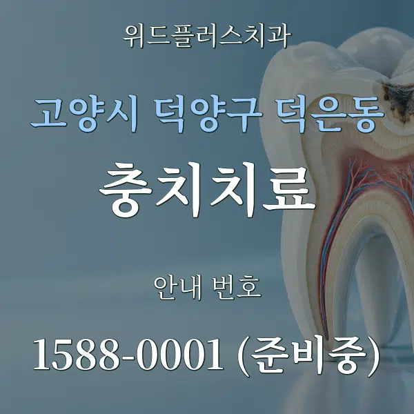고양시 덕양구 덕은동 충치치료 대표 안내 그래픽