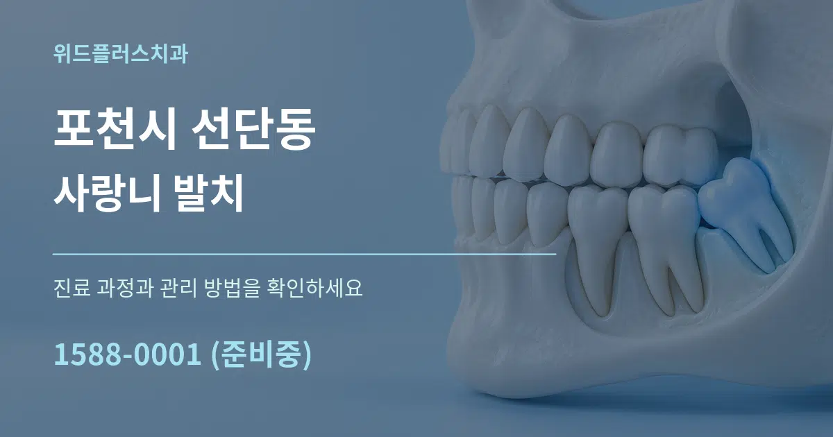 포천시 선단동 사랑니 발치 서비스 이용 안내 그래픽