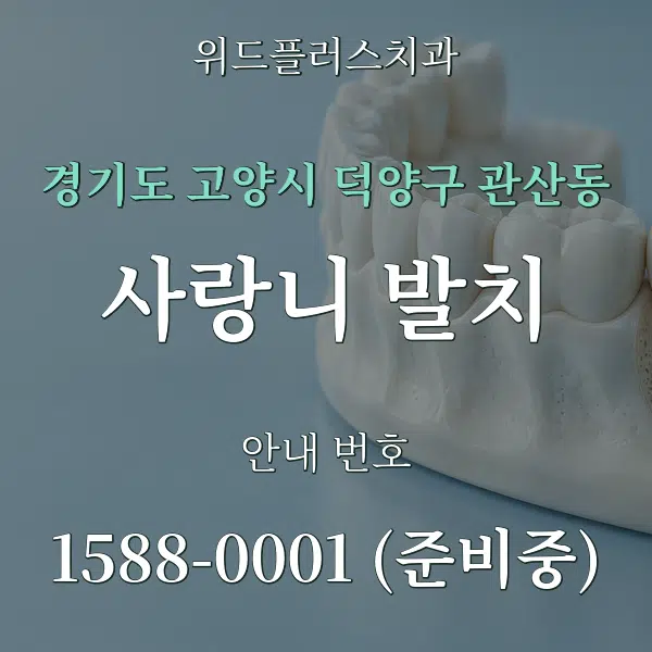 경기도 고양시 덕양구 관산동 사랑니 발치 대표 안내 그래픽