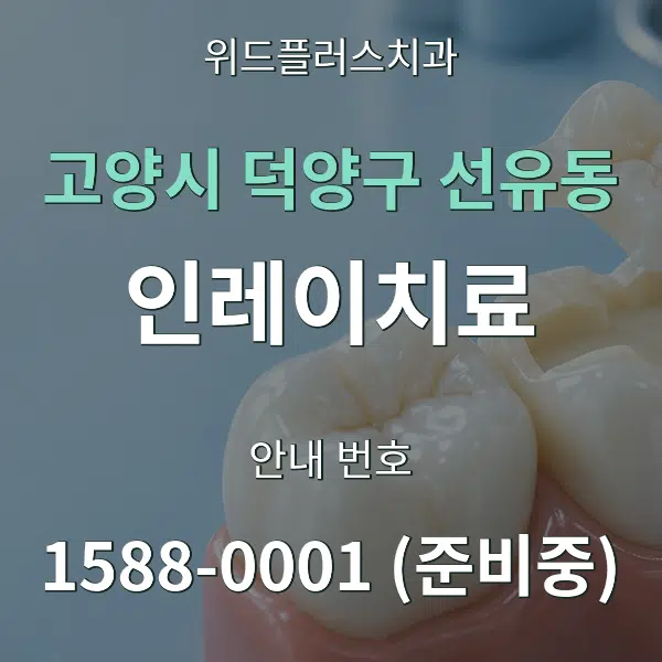 고양시 덕양구 선유동 인레이치료 대표 안내 그래픽