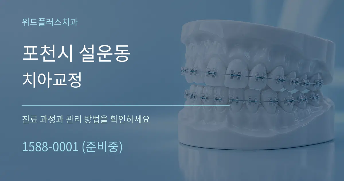 포천시 설운동 치아교정 작업 조건 안내 그래픽
