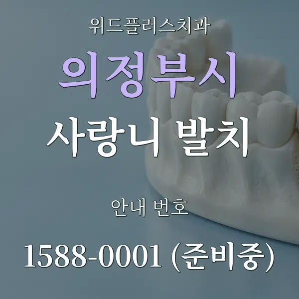 의정부시 사랑니 발치 대표 안내 그래픽