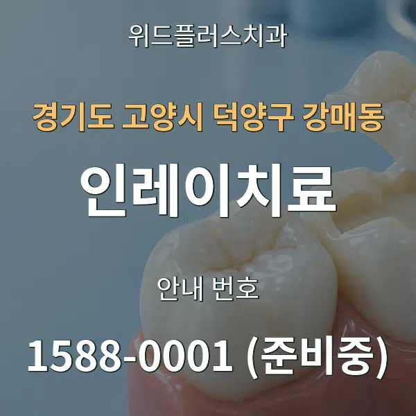 경기도 고양시 덕양구 강매동 인레이치료 대표 안내 그래픽