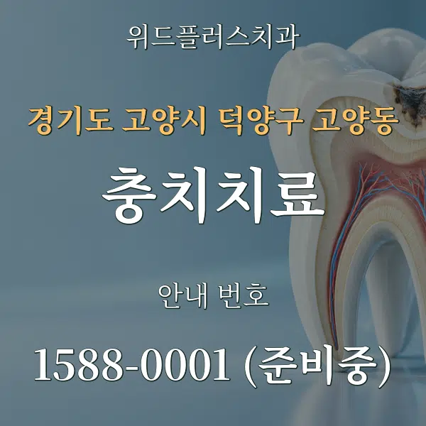 경기도 고양시 덕양구 고양동 충치치료 대표 안내 그래픽
