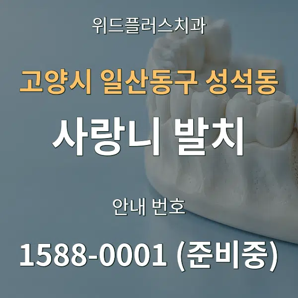 고양시 일산동구 성석동 사랑니 발치 대표 안내 그래픽