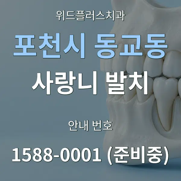 포천시 동교동 사랑니 발치 대표 안내 그래픽
