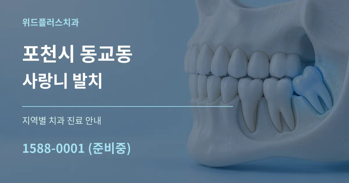 포천시 동교동 사랑니 발치 대표 안내 그래픽